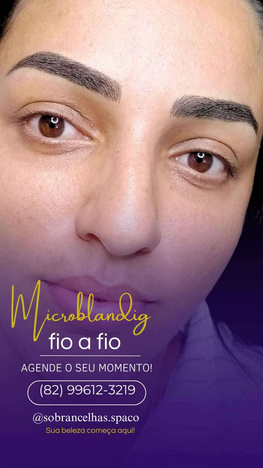 Microblanding fio a fio
